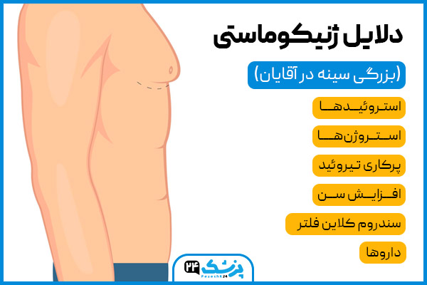 دلایل ژنیکوماستی (بزرگی سینه) در آقایان در مشهد