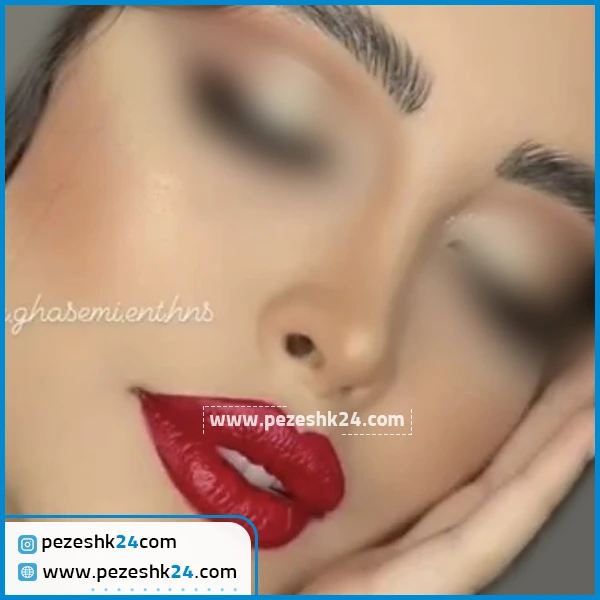 عمل زیبایی بینی دکتر قاسمی کرج