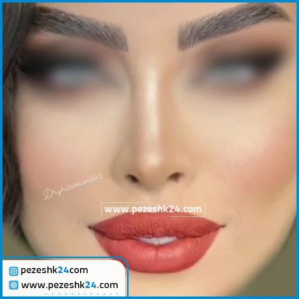 عمل بینی دکتر افشین قاسمی