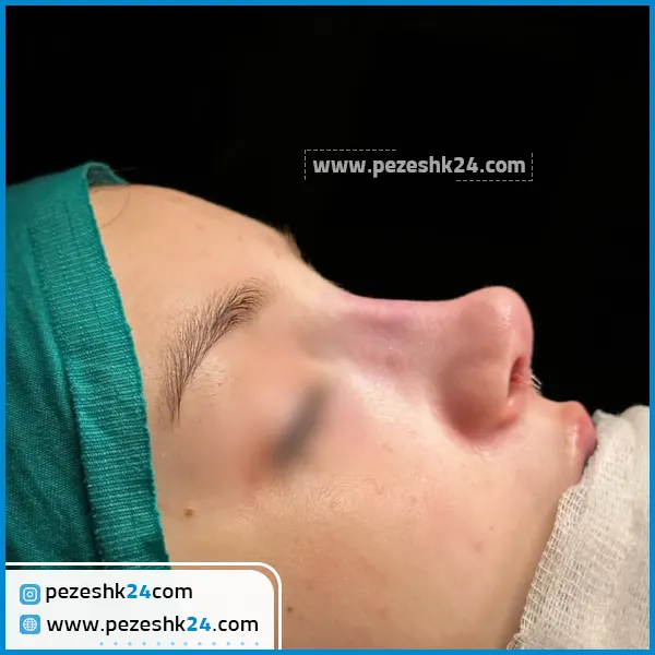 دماغ نیمه فانتزی دخترانه