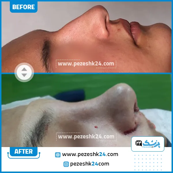 دکتر علی حجاری جراح بینی اهواز