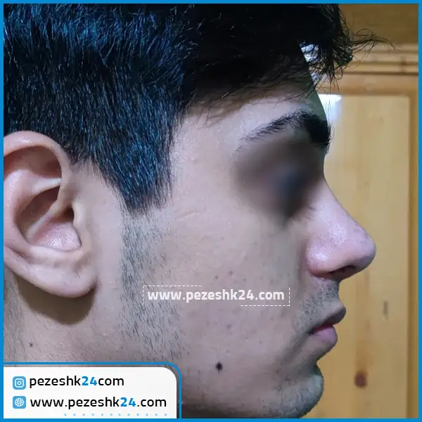 عمل بینی دکتر کردونی در اهواز