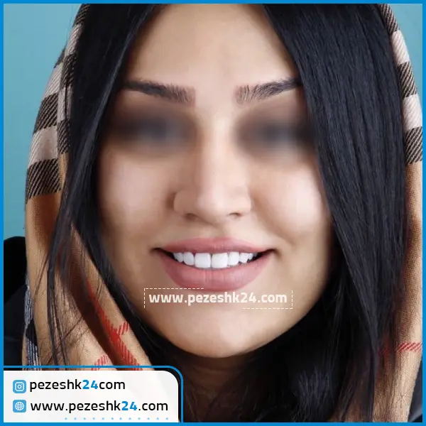 نمونه کامپوزیت دکتر شاهرخی در مشهد