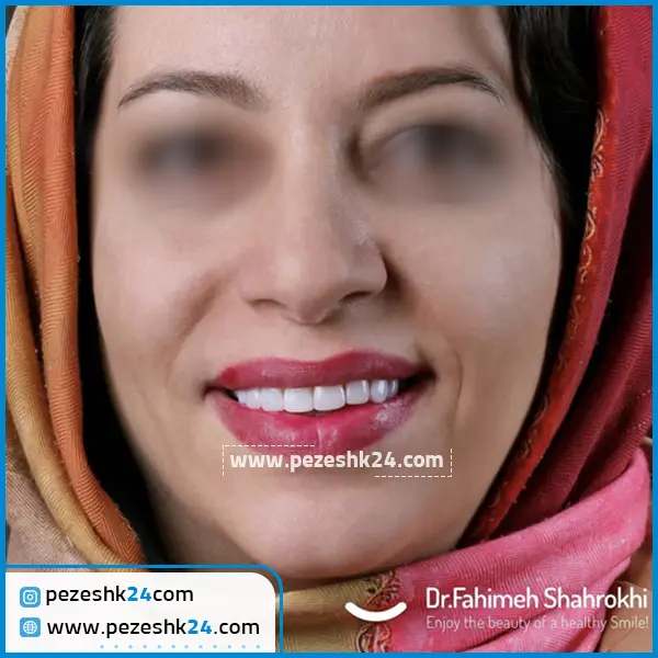 نمونه کار دکتر فهیمه شاهرخی