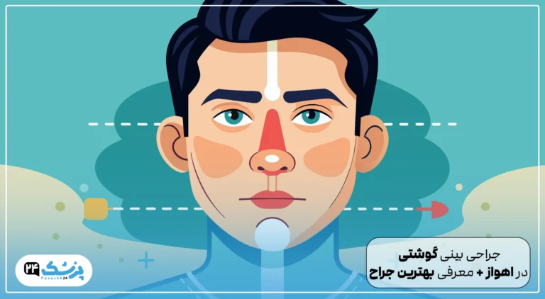 جراحی بینی گوشتی در اهواز