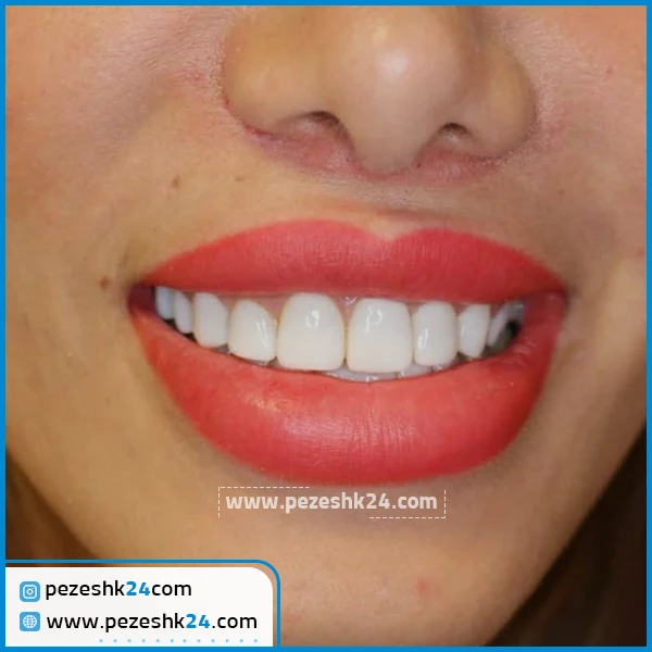 کامپوزیت دندان دکتر آرش راد