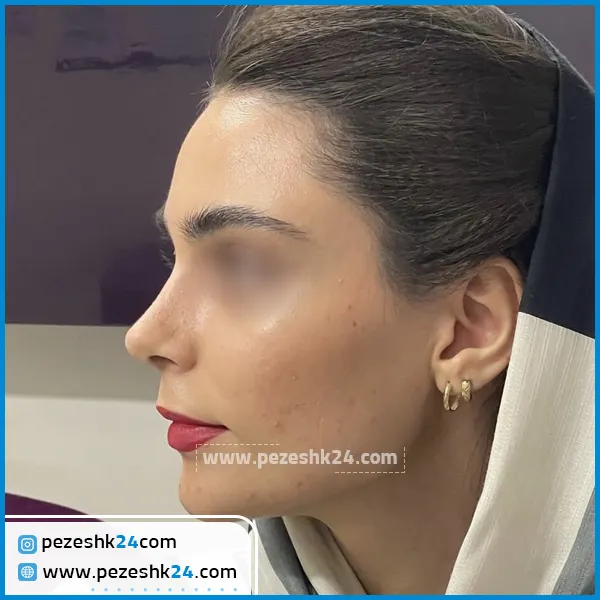 جراحی بینی دکتر صادقی