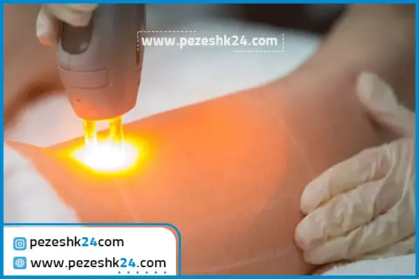 کلینیک لیزر تهران هورسام