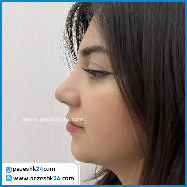 بهترین دکتر ترمیم بینی در رشت