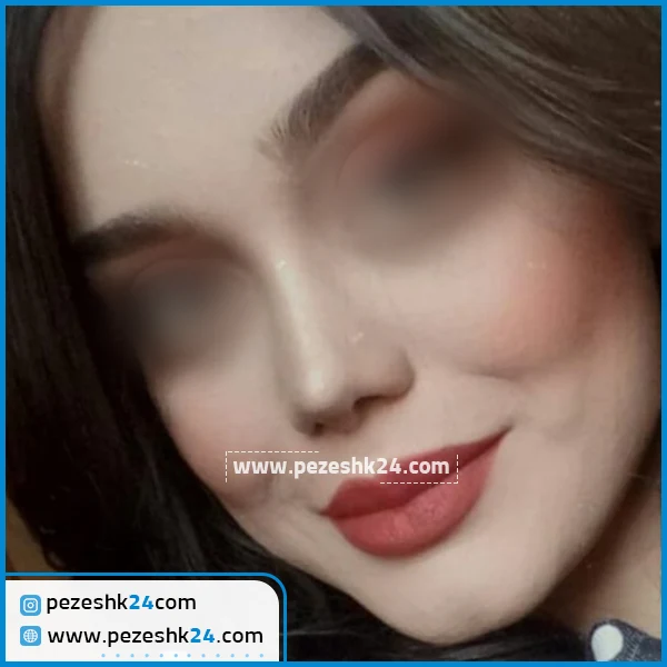 عمل زیبایی بینی دکتر واحدی پور