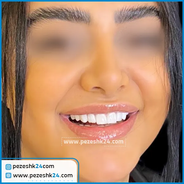 نمونه کامپوزیت دکتر اردوان صنفی