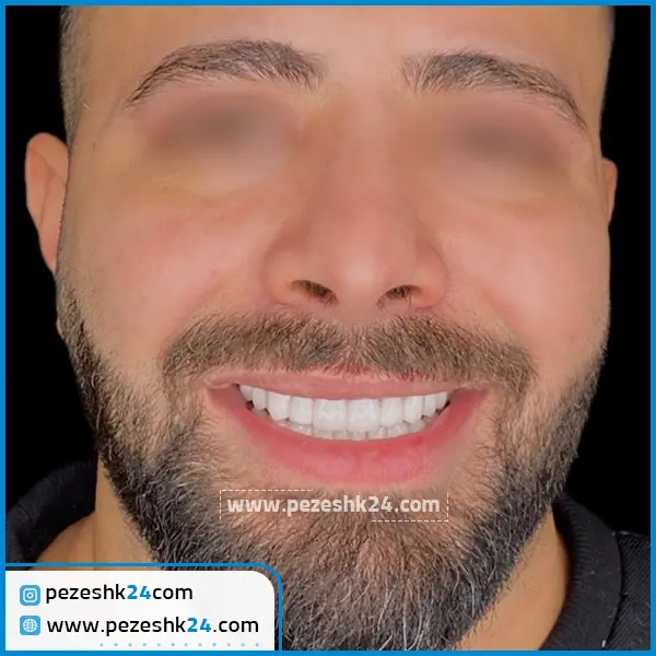 نمونه کامپوزیت دکتر صنفی