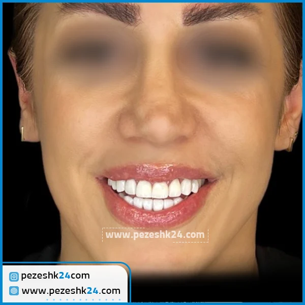 نمونه کامپوزیت دکتر اردوان صنفی تهران