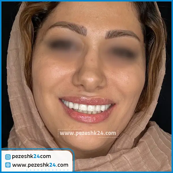 نمونه کامپوزیت دکتر صنفی تهران