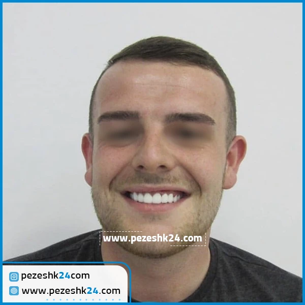 کامپوزیت دندان کلینیک گیشا