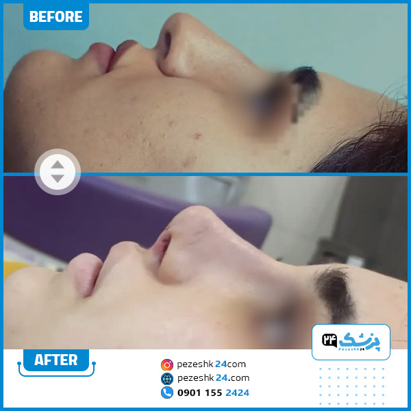 نمونه کار دکتر بهرام عزیزی کرمانشاه