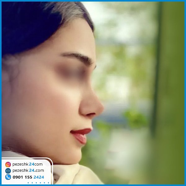 نمونه جراحی بینی دکتر بهرام عزیزی در کرمانشاه