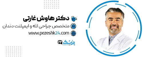 دکتر هاوش غارتی دندانپزشک تهران