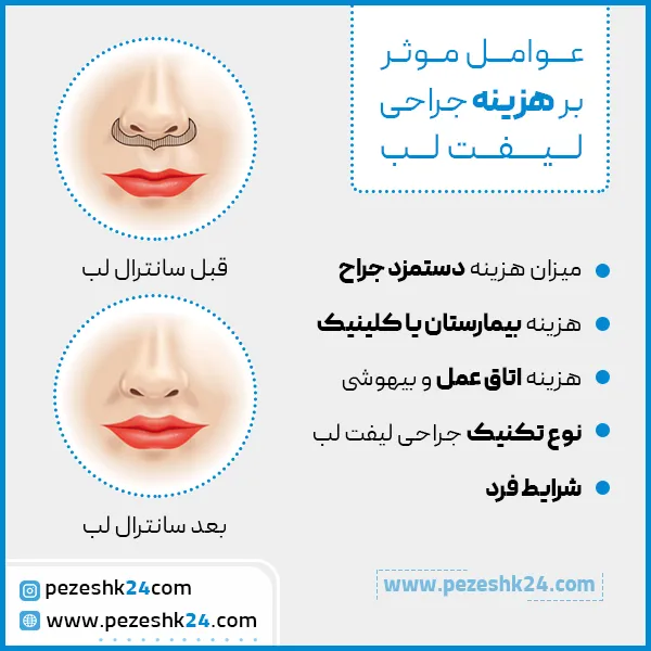 عوامل موثر بر هزینه لیفت لب