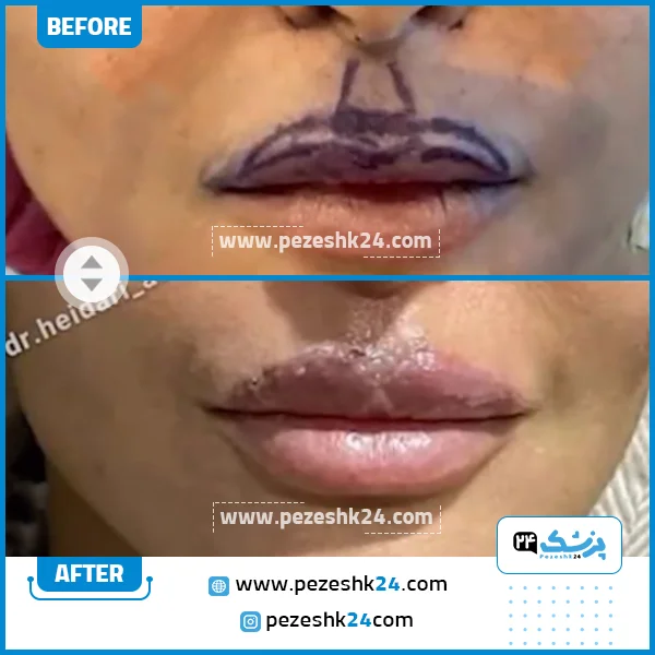 عکس قبل و بعد سانترال لب دکتر حیدری