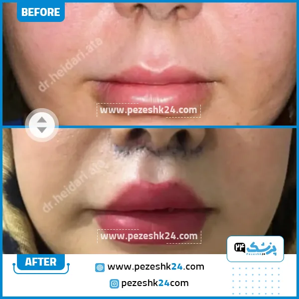 عکس قبل و بعد از سانترال لب دکتر حیدری