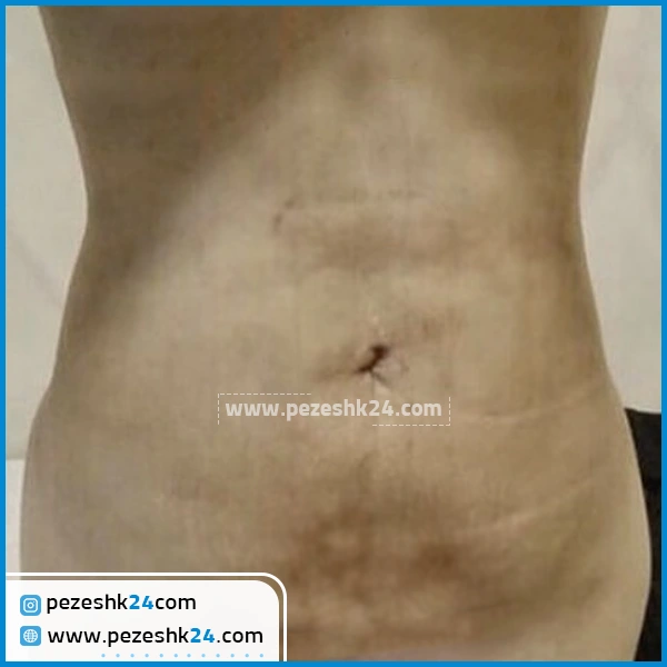 پیکرتراشی دکتر برجسته مشهد