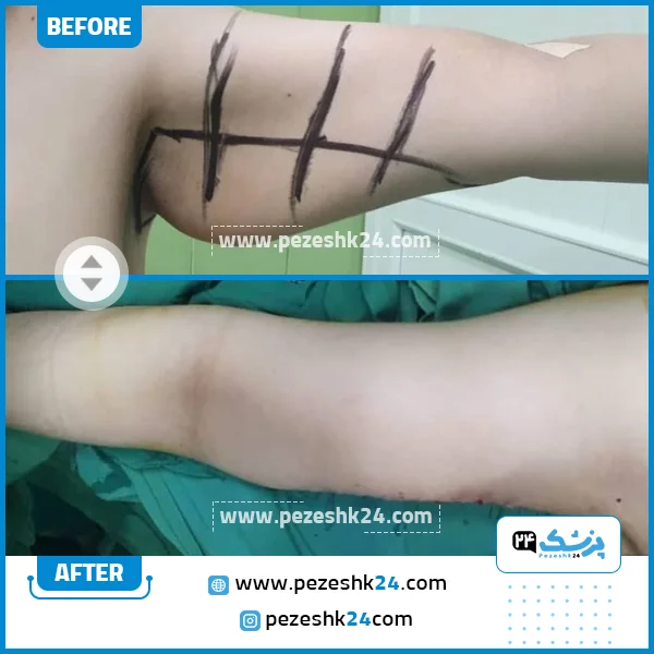 قبل و بعد پیکرتراشی دکتر قربانزاده