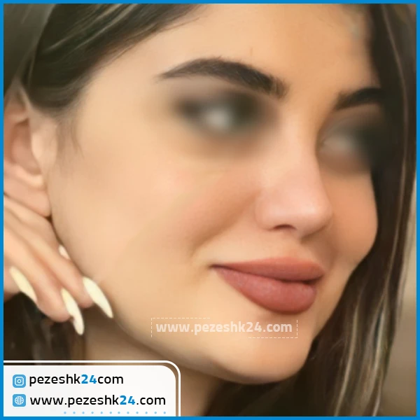 جراحی بینی دکتر کاویانی فر