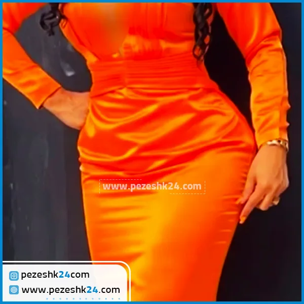 جراحی پیکرتراشی دکتر قربانزاده مشهد