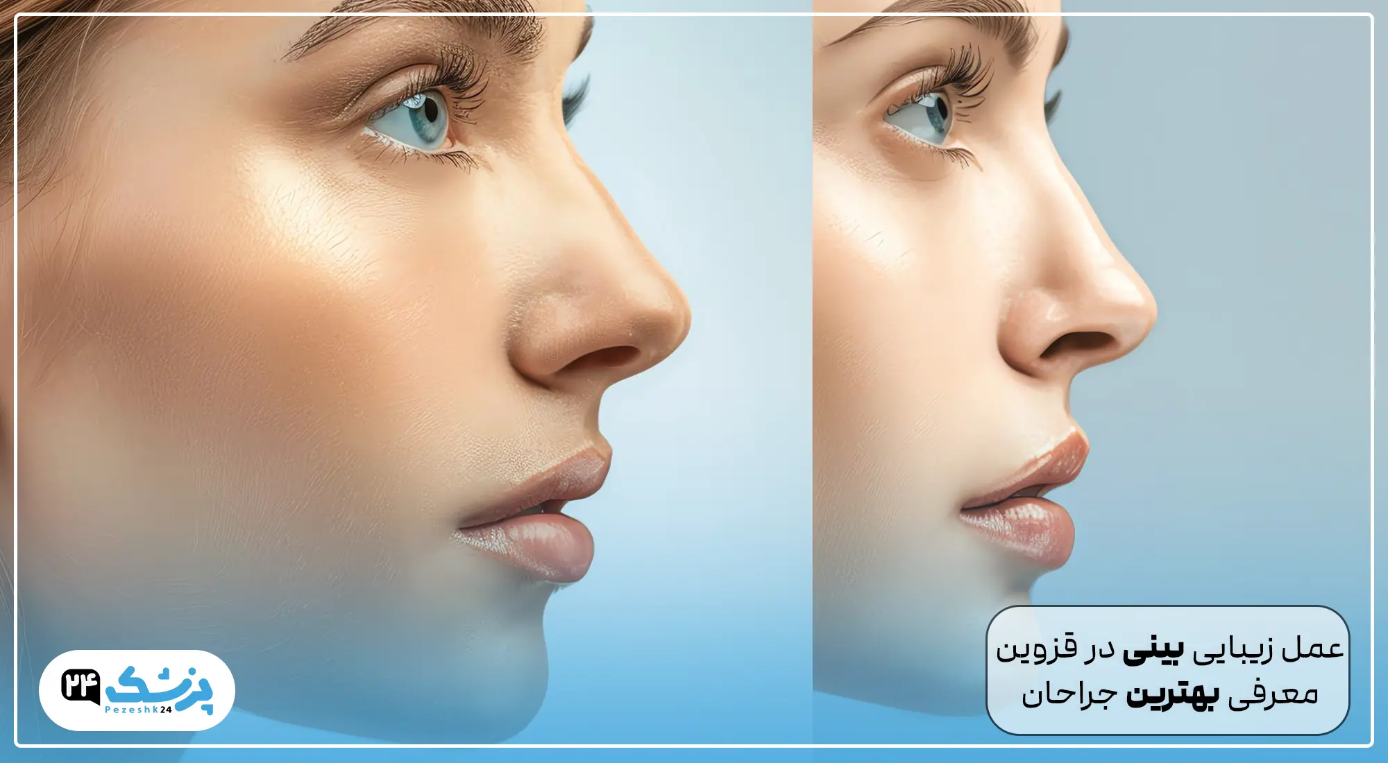 عمل بینی در قزوین