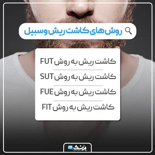 انواع روش های کاشت ریش