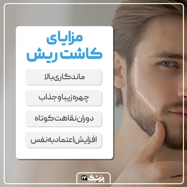 مزایای کاشت ریش در تهران