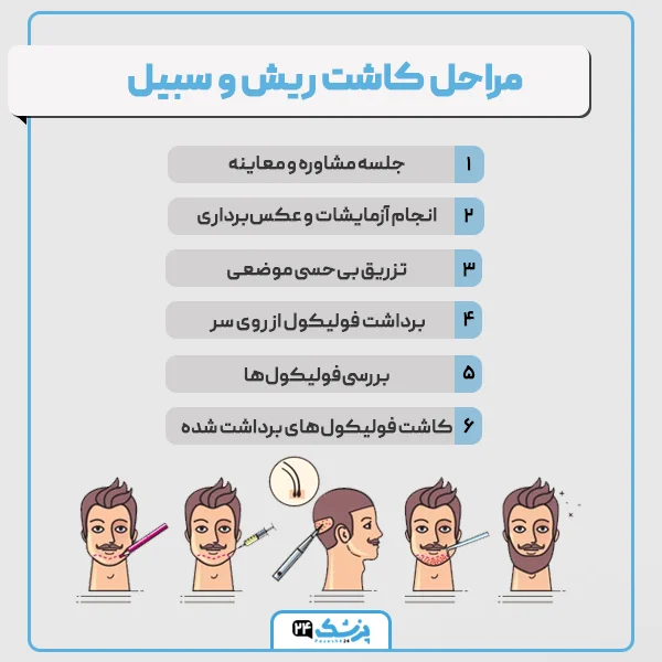 مراحل کاشت ریش تهران