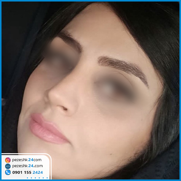 عمل بینی دکتر عقیلی