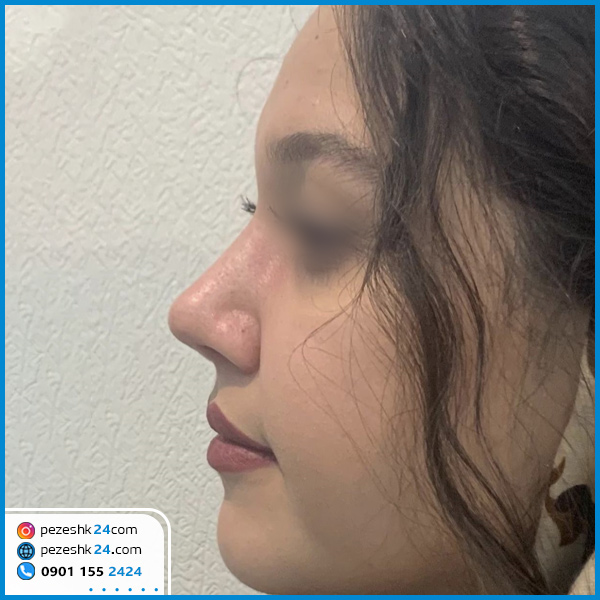 جراحی بینی دکتر محمدی