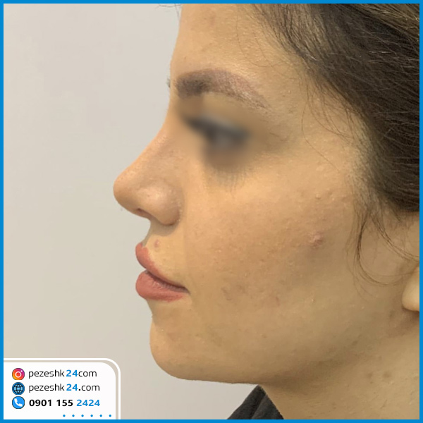 عمل بینی دکتر محمدی