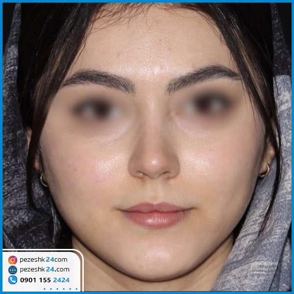 جراحی زیبایی بینی دکتر محمدی