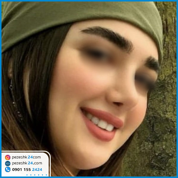 جراحی بینی دکتر رستمی گرگان