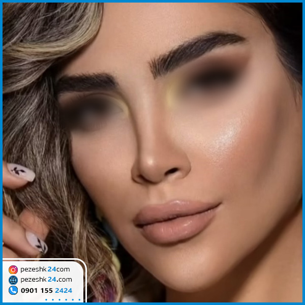 جراحی زیبایی بینی دکتر یعقوبی