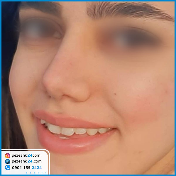 عمل بینی دکتر عالیشاهی در گرگان