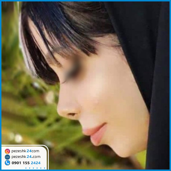 عمل بینی دکتر عالیشاهی در گرگان