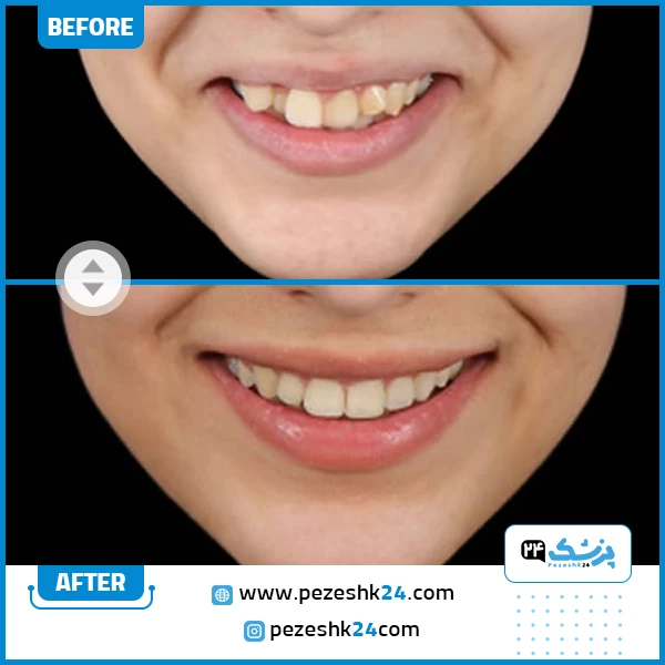 نمونه ارتودنسی دکتر محولاتی مشهد