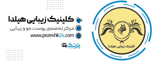کلینیک زیبایی هیلدا تهران
