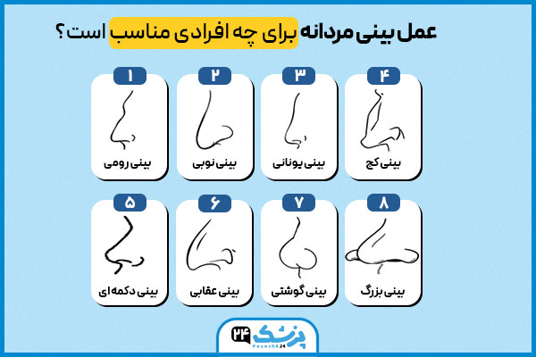 کاندیدای عمل بینی مردانه