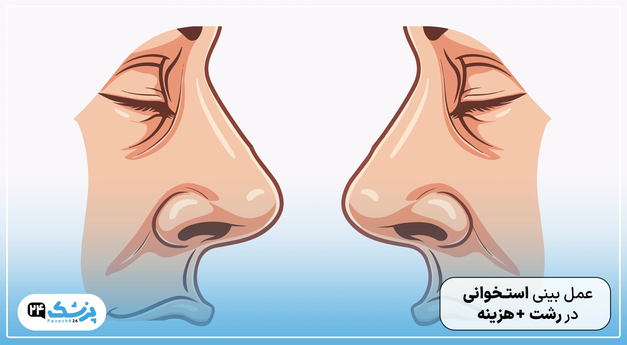 عمل بینی استخوانی در رشت