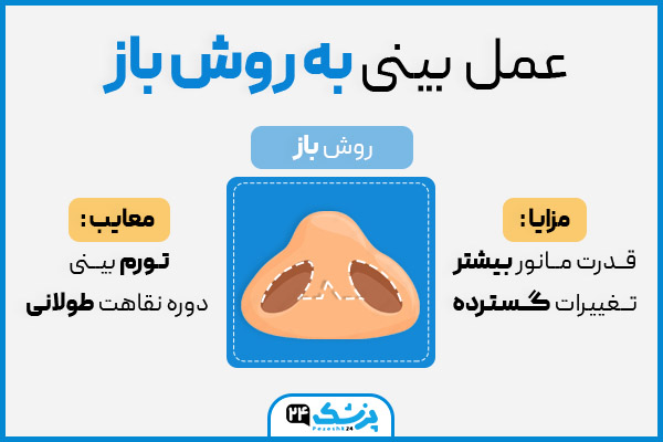مزایا و معایب عمل بینی به روش باز