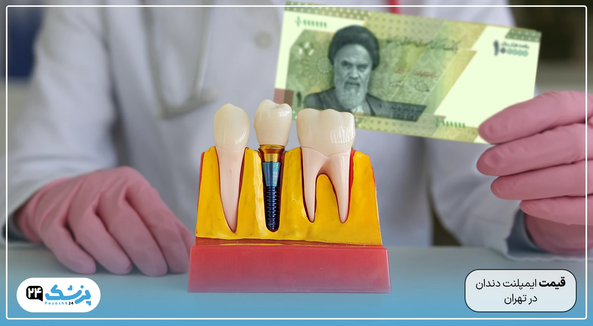 قیمت ایمپلنت دندان در تهران