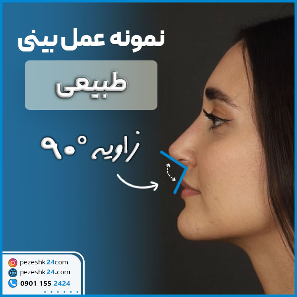 نمونه عمل بینی طبیعی