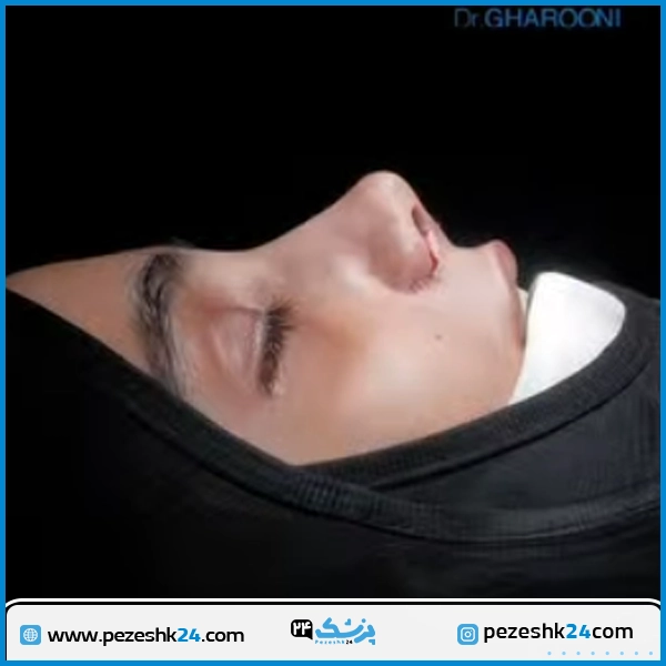 نمونه عمل زیبایی بینی دکتر قارونی تهران