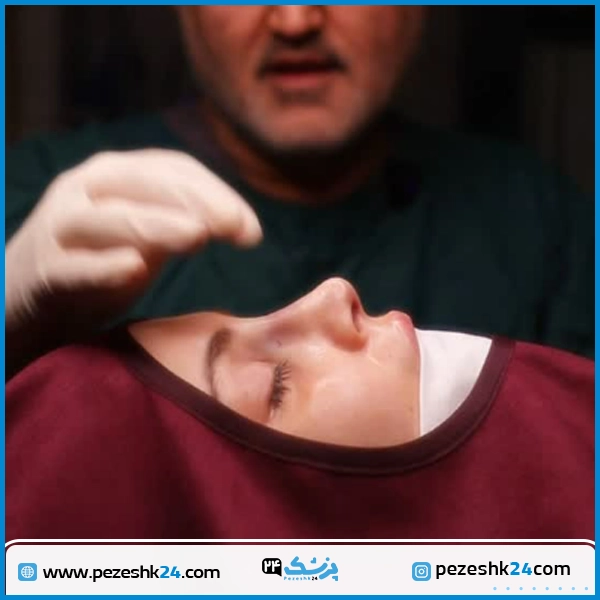 نمونه عمل زیبایی بینی دکتر حسنانی تهران